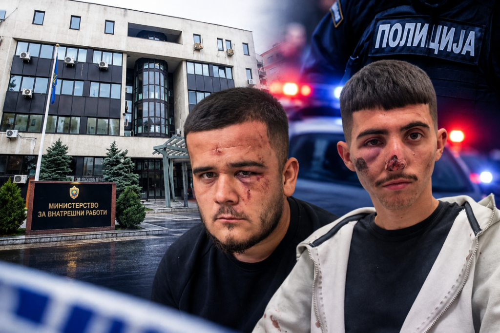 Policia heton policinë! A do të zbardhet dhuna ndaj dy të rinjve në Shkup, apo gjithçka do të mbetet në letër?
