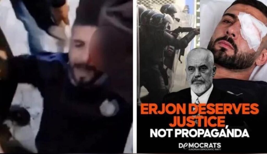 Demokratët Europianë kritikojnë Ramën për plumbat e gomës: Erjon Vishkulli ka nevojë për drejtësi, jo për propagandë!