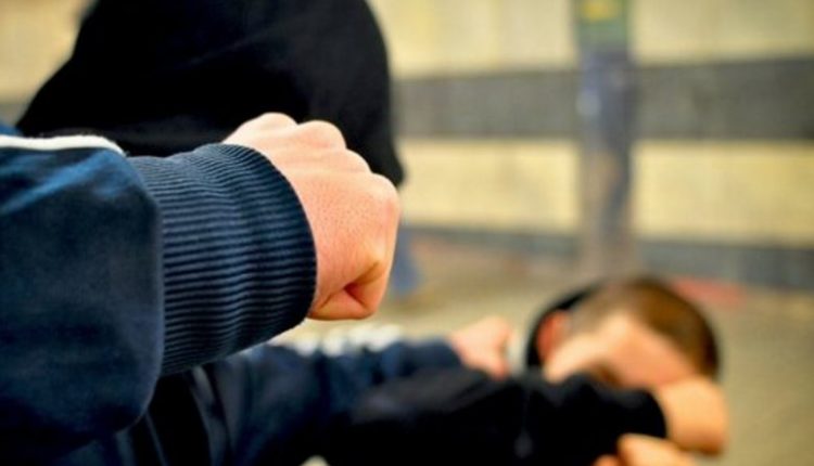 14-vjeçari sulmohet fizikisht nga bashkëmoshatari në Tetovë
